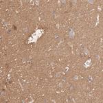 SEPT6 Antibody in Immunohistochemistry (Paraffin) (IHC (P))