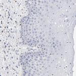 SEPT6 Antibody in Immunohistochemistry (Paraffin) (IHC (P))