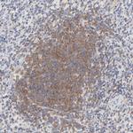 SEPT6 Antibody in Immunohistochemistry (IHC)