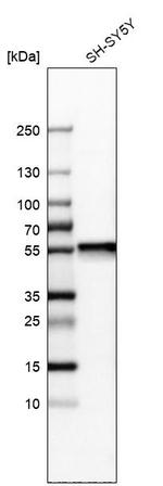 SEPT6 Antibody in Western Blot (WB)