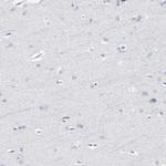 PAGE1 Antibody in Immunohistochemistry (Paraffin) (IHC (P))