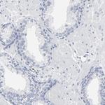PAGE1 Antibody in Immunohistochemistry (Paraffin) (IHC (P))