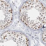 PAGE1 Antibody in Immunohistochemistry (Paraffin) (IHC (P))