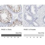 PAGE1 Antibody in Immunohistochemistry (IHC)