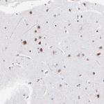 SNRPB Antibody in Immunohistochemistry (Paraffin) (IHC (P))