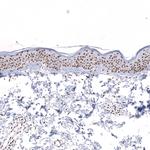 SNRPB Antibody in Immunohistochemistry (Paraffin) (IHC (P))