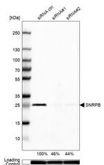 SNRPB Antibody