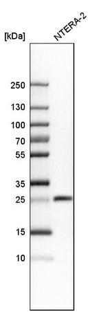 SNRPB Antibody in Western Blot (WB)