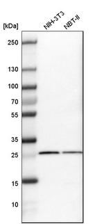 SNRPB Antibody in Western Blot (WB)