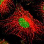 ZNF192 Antibody in Immunocytochemistry (ICC/IF)