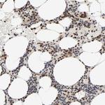 ZNF192 Antibody in Immunohistochemistry (Paraffin) (IHC (P))