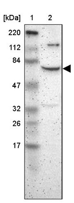 ZNF192 Antibody in Western Blot (WB)