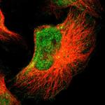 FOXN2 Polyclonal Antibody