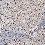 FOXN2 Antibody in Immunohistochemistry (Paraffin) (IHC (P))