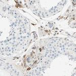 TMEM260 Antibody in Immunohistochemistry (Paraffin) (IHC (P))