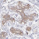 RPLP0 Antibody in Immunohistochemistry (IHC)