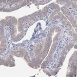 RPLP0 Antibody in Immunohistochemistry (IHC)