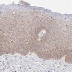RPLP0 Antibody in Immunohistochemistry (IHC)