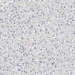RPLP0 Antibody in Immunohistochemistry (IHC)