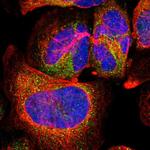 Cathepsin H Polyclonal Antibody