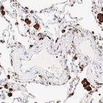 Cathepsin H Antibody in Immunohistochemistry (IHC)