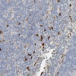 Galectin 2 Antibody in Immunohistochemistry (IHC)