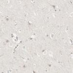 Galectin 2 Antibody in Immunohistochemistry (IHC)