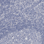 Adenylate Kinase 7 Antibody in Immunohistochemistry (Paraffin) (IHC (P))