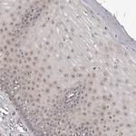 Nop25 Antibody in Immunohistochemistry (Paraffin) (IHC (P))