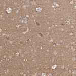 Septin 3 Antibody in Immunohistochemistry (IHC)