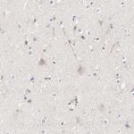 ARHGEF6 Antibody in Immunohistochemistry (Paraffin) (IHC (P))
