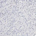 ARHGEF6 Antibody in Immunohistochemistry (Paraffin) (IHC (P))