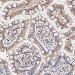 ARHGEF6 Antibody in Immunohistochemistry (Paraffin) (IHC (P))