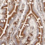 PARP12 Antibody in Immunohistochemistry (Paraffin) (IHC (P))