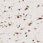 PARP12 Antibody in Immunohistochemistry (Paraffin) (IHC (P))