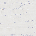 PARP12 Antibody in Immunohistochemistry (Paraffin) (IHC (P))