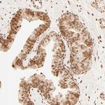 FAM50A Antibody in Immunohistochemistry (Paraffin) (IHC (P))