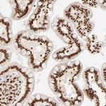 FAM50A Antibody in Immunohistochemistry (Paraffin) (IHC (P))