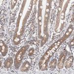 VIPAS39 Polyclonal Antibody