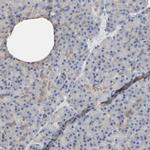 NDRG2 Antibody in Immunohistochemistry (IHC)