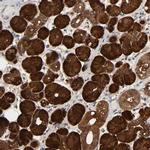 NDRG2 Polyclonal Antibody