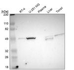 NDRG2 Antibody in Western Blot (WB)