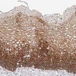 VIPAS39 Polyclonal Antibody