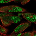 ZDHHC15 Polyclonal Antibody