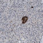 ZDHHC15 Antibody in Immunohistochemistry (Paraffin) (IHC (P))