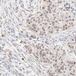 RBM3 Antibody in Immunohistochemistry (Paraffin) (IHC (P))
