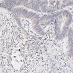 RBM3 Antibody in Immunohistochemistry (Paraffin) (IHC (P))