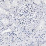 RBM3 Antibody in Immunohistochemistry (Paraffin) (IHC (P))
