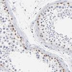 RBM3 Antibody in Immunohistochemistry (Paraffin) (IHC (P))
