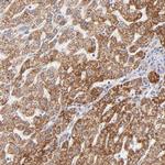 TIMM8A Antibody in Immunohistochemistry (Paraffin) (IHC (P))